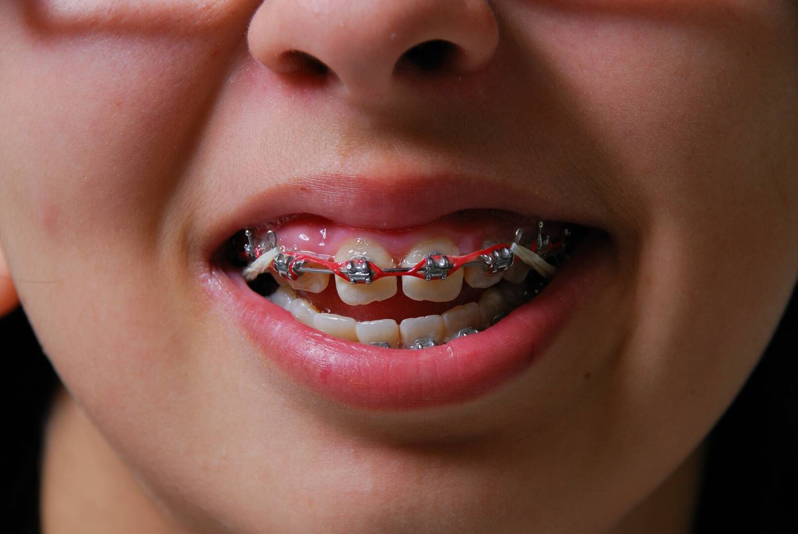 Dentistry Henley Beach SA