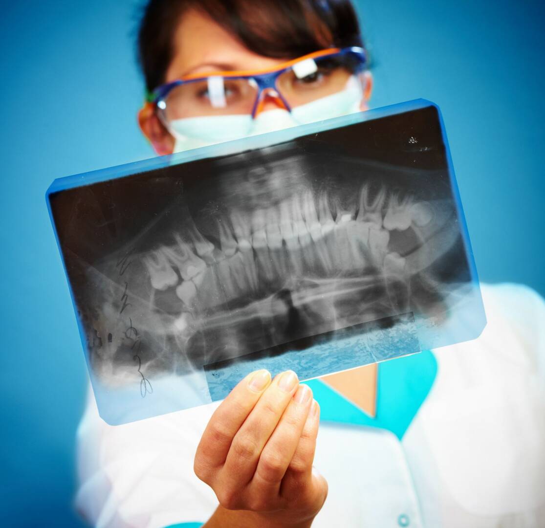 Dental Bridge Marysville WA